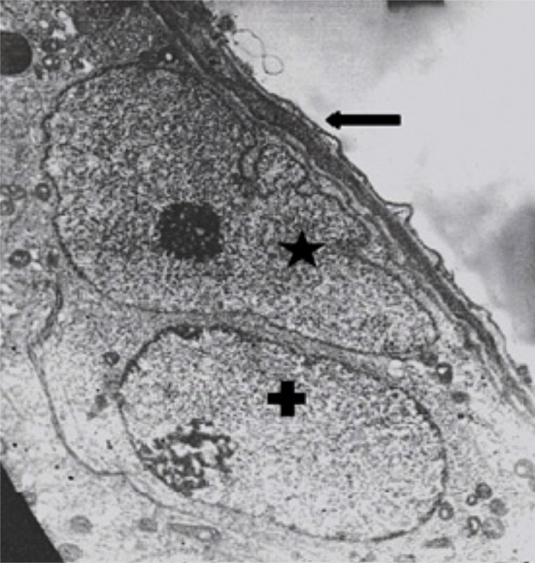 Figure 3 Ultrastructural micrograph of seminiferous tubule in control group: myoepithelium (Arrow), nucleous of Sertoli cell (*) and a spermatogonia (+). Magnification of 4400