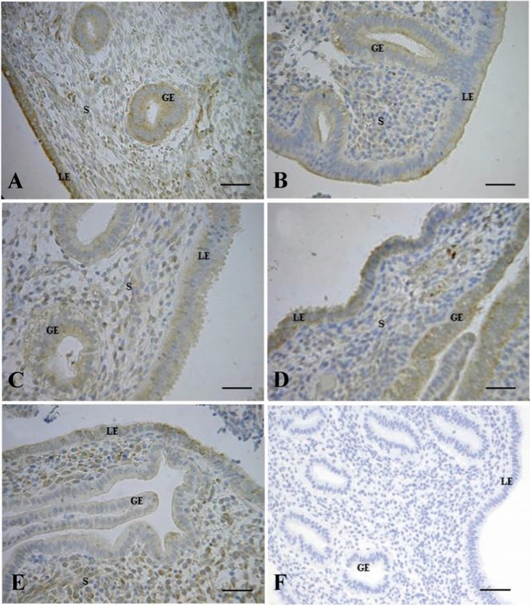 Figure 2 Immunohistochemical staining of human endometrium for VEGF. Endometrial tissues at the A: proliferative phase (days 7-12); B: peri-ovulatory phase (days 13-15); C: early-secretory phase (days 16-18); D: mid-secretory phase (days 19-21) and E