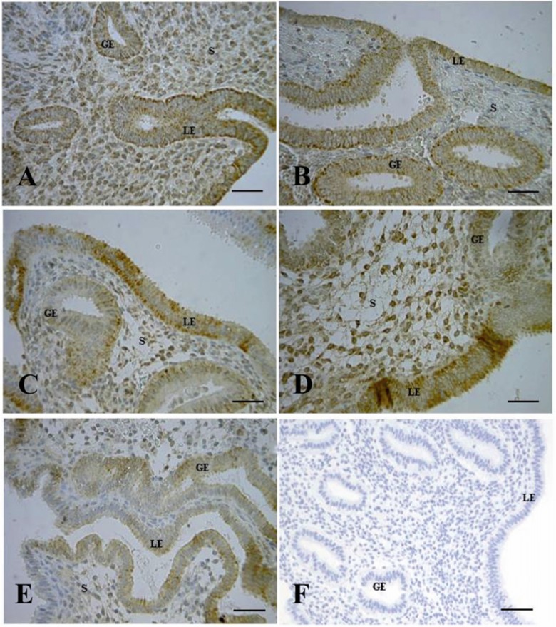 Figure 3 Immunohistochemical staining of human endometrium for Flk-1. Endometrial tissues at the A: proliferative phase (days 7-12); B: peri-ovulatory phase (days 13-15); C: early-secretory phase (days 16-18) D: mid-secretory phase (days 19-21) and E