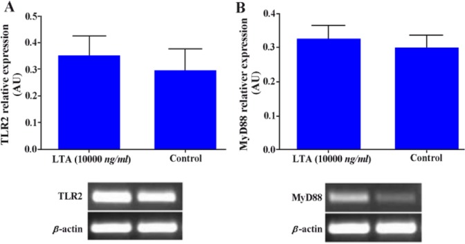 Figure 5 Effect of LTA on TLR2 and MyD88 gene expression in WECs. WECs were treated with LTA (10000 ng/ml) for 8 hr and expression of TLR2 and MyD88 genes was evaluated by RT-PCR. Representative TLR2 and MyD88 PCR bands are shown at the bottom of eac