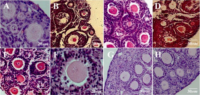 Figure 3. Light microscopic images of mouse ovarian tissue; A: non-frozen; B: DCV1 group that vitrified alone in 5% EG, C: DCV2 group that vitrified in 10% EG; D: DCV3 group that vitrified alone in 5% DMSO, E: DCV4 group that vitrified in 10% DMSO, F