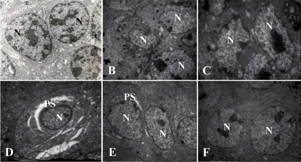 Figure 5. The electron micrograph of granulosa cells of secondary follicles from control or non-frozen (Ax4795), DCV1 (Bx2784) and DCV2 (Cx3597) DCV5 (Dx3597), DCV6 (Ex2156) and DCV7 (Fx2784). The granulosa cells in single cryoprotectant appeared to
