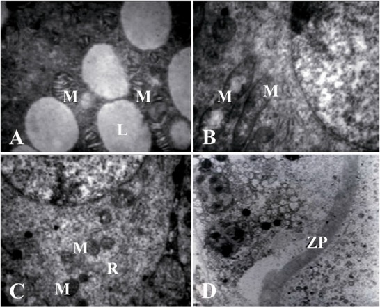 Figure 6. The electron micrograph of mithochondria (M) arrangement of secondary follicles. A: Numerous lipid droplets (L) are found in close association with atypical or irregularly shaped mithochondria with longitudinally oriented cristae in DCV 1–4
