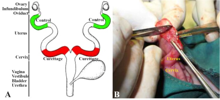 Figure 1. A) Schematic illustration of the rabbit uteri. Red marks show incision and curettage sites of the two uteri and green marks show the control sampled sites. B) Surgical procedure of intrauterine curettage of the right rabbit uterus using a s
