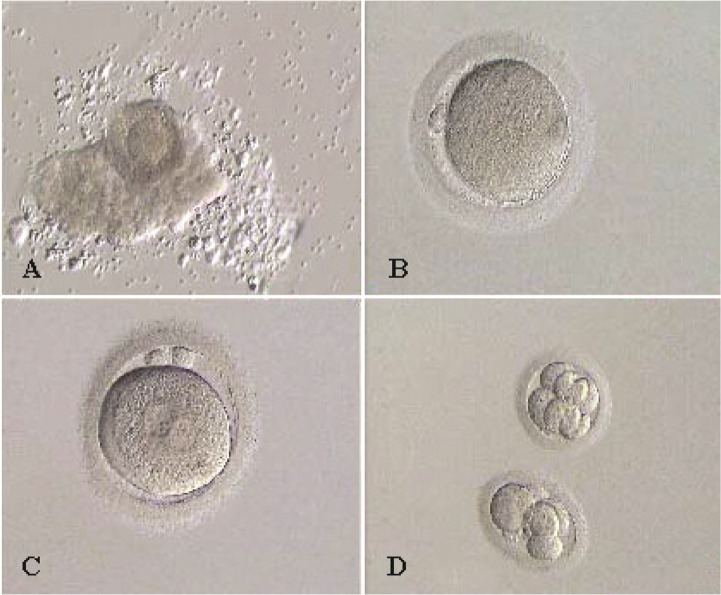 Figure 1. IVM laboratory course; A: Obtained GV oocyte with cumulus corona complex; B: MII oocyte following IVM; C: PN stage; D: Transferred embryo