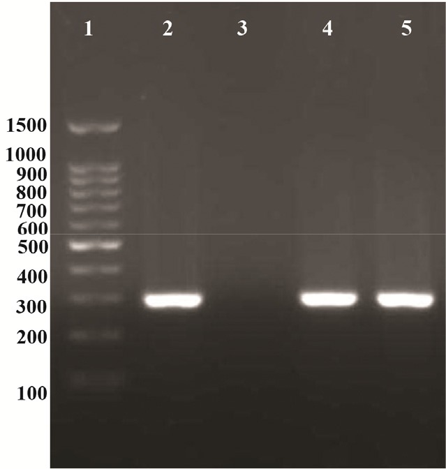 Figure 1. PCR test for Chlamydia trachomatis detection, lane (1) 100 bp DNA ladder (CinnaClon), lane (2) PCR positive control (300 bp), lane (3) negative control, lanes (4 and 5) positive PCR results (300 bp)