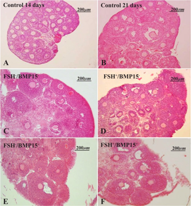 Figure 1. Photomicrographs of cultured and non-cultured mouse ovaries sections stained with hematoxylin and eosin: Micrographs of non-cultured; A: 14 day mouse ovary; B: 21 day mouse ovary, C: 14 day mice ovaries cultured without FSH and BMP15 (FSH−/