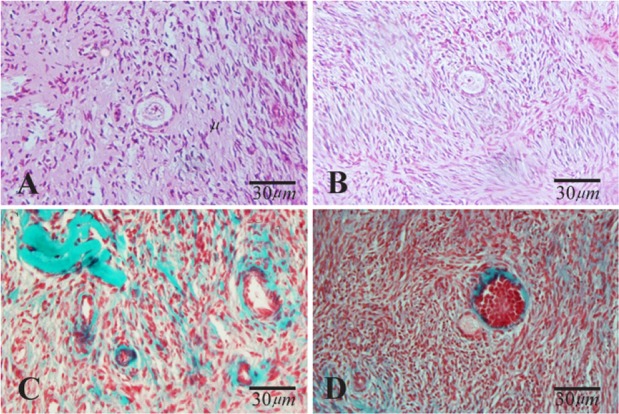Figure 1. Light microscopic images of human ovarian cortical tissue after hematoxylin and eosin (A and B) and Masson Trichrome (C and D) staining before in vitro culture. A and C: non-vitrified group; B and D: vitrified group. The normal morphology o