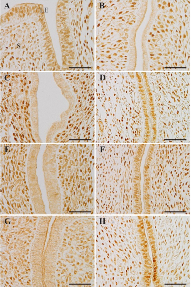 Figure 3. Localization of progesterone receptors. (A) The uterus of delayed implantation (DI) mouse. The DI uteri treated with 20 ng estrogen (E2) (B), leukemia inhibitory factor (LIF) (C, D) or 3 ng E2 (E, F). The uteri in ovariectomized pseudopregn