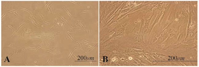 Figure 1. A: Sertoli cells 4–5 days after culture with extended expansions; B: the isolated and proliferated cell population created a monolayer of cells after 2 weeks of cultivation