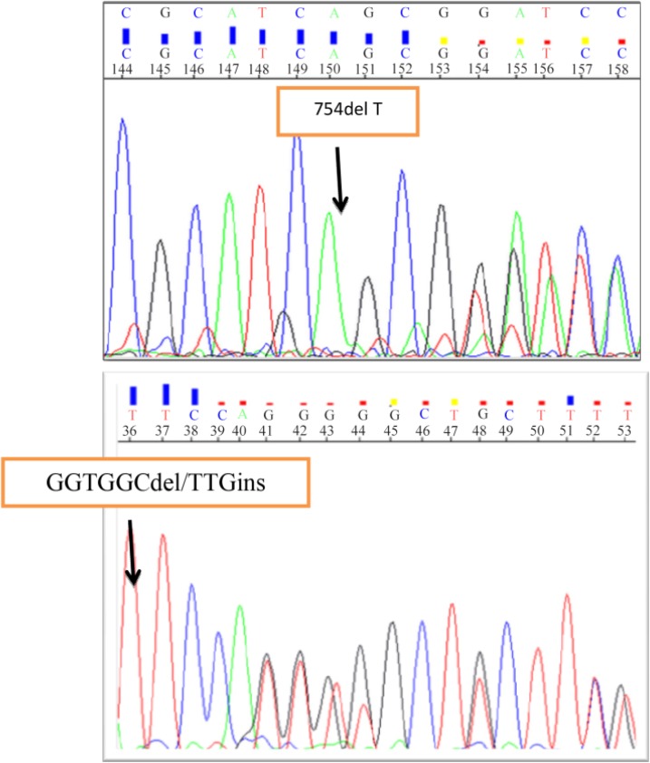 Figure 1. Novel mutations were identified in CFTR gene by sequencing