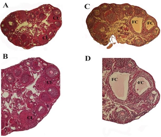 Figure 1. Morphological comparison of control and DHEA-treated PCOS mice ovaries. Control/vehicle ovary showed several follicles in different developmental stages. Corpus luteum (CL) structure is also shown (A, B); DHEA-treated PCOS mouse ovary showe
