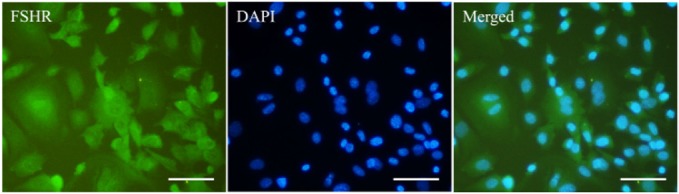 Figure 3. Immunostaining of isolated granulosa cells with FSHR antibody that represented FSHR (green) expression in these cells. Nuclei (blue) were counterstained using DAPI. Scale bar: 100 μm