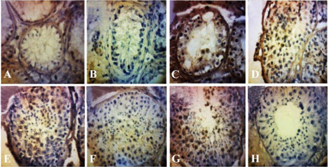 Figure 1. Microphotograph of immunohistochemical CDC25A staining in testis tissue (400X magnification). A: Johnsen scoring 2; B: Johnsen scoring 3; C: Johnsen scoring 4; D: Johnsen scoring 5; E: Johnsen scoring 6; F: Johnsen scoring 7; G: Johnsen sco