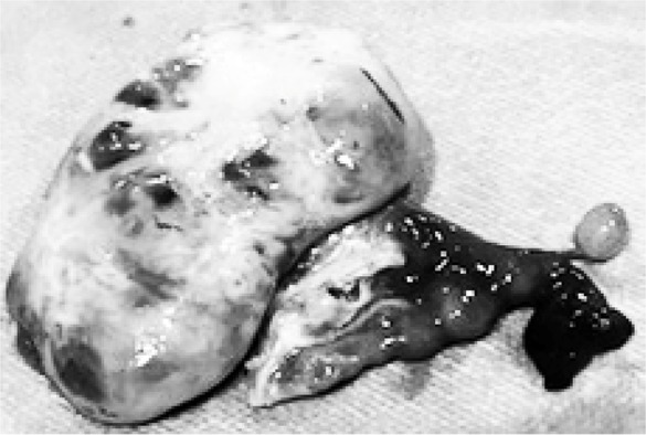 Figure 2. Adnexectomy specimen before follicular aspiration