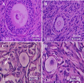 Figure 1. Light microscopy of human ovarian cortex after 14 days of in vitro culture; samples stained by haematoxylin and eosin. The morphology of follicles in the non-vitrified–LIF+ group (A), vitrified–LIF+ (B) non-vitrified–LIF− (C) and vitrified–