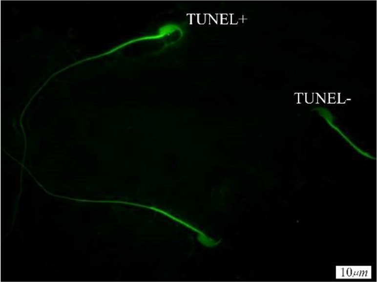 Figure 1. TUNEL staining of spermatozoa; TUNEL+ indicates sperm cells with abnormal DNA and TUNEL− indicates sperm cells with normal DNA (×100 eyepiece magnification)