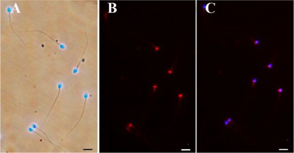 Figure 1. PLCζ immunofluorescence staining. The sperm nuclei are counterstained with DAPI. A: Merged DAPI and bright field images. B: Anti-PLCζ immunofluorescence. C: Merged DAPI and PLCζ stains. Bar=10 μm