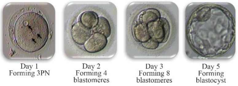 Figure 1. The development of 3PN embryos