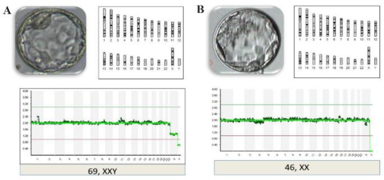 Figure 2. NGS profile of 3PN embryos
