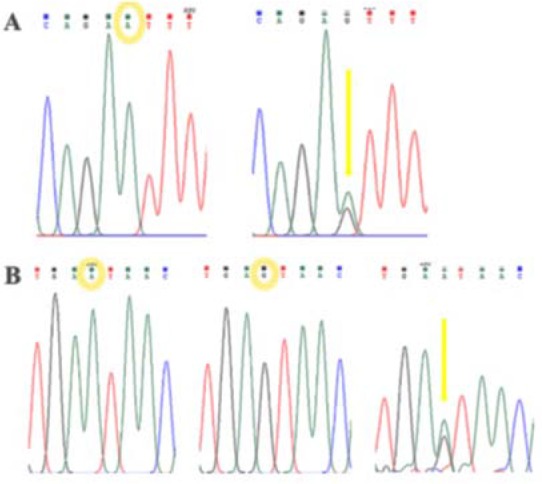 Figure 2. A: The graph of sequencing results for rs12470652. B: The graph of sequencing results for rs2293275