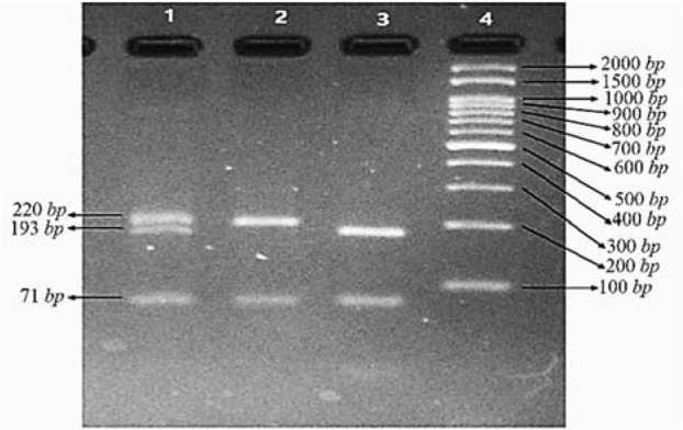 Figure 3. Electrophoresis of three samples after digestion with PVUII. (Lane 1: heterozygote for the 6bp insertion, Lane 2: no insertion, Lane 3: homozygote for the 6bp insertion, Lane 4: 100 bp DNA ladder)