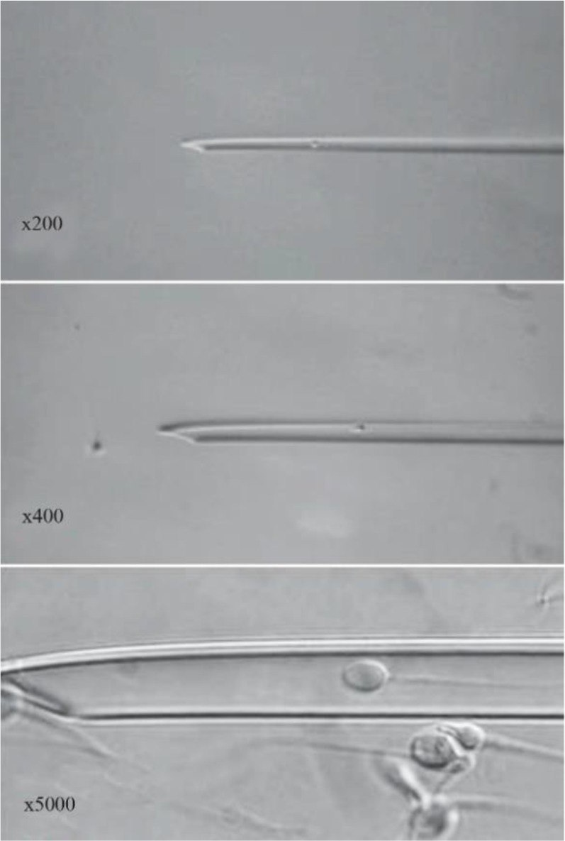 Figure 1. Human spermatozoon: morphological appearance in microinjection pipette, ×200, ×400 and ×6000. The morphological integrity of sperm is clearly visible at ×6000