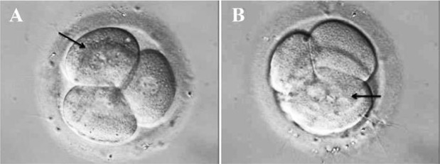 Figure 2. A) Two nuclei in a blastomere (black arrow); B) Multiple nuclei in a blastomere (black arrow)