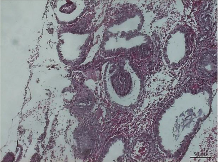 Figure 1. Representative samples of H&E-stained in the secretory endometrium histology