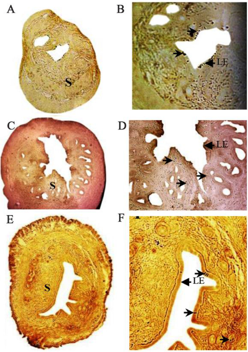 Figure 2. Immunohistochemistry of PCNA in OVX-vehicle treated (control) (A & B), OVX-E2 treated (C & D) and OVX- extract treated (E & F) mice. PCNA expression (arrow head) is found in the endometrial stromal cells (S) and luminal epitheli