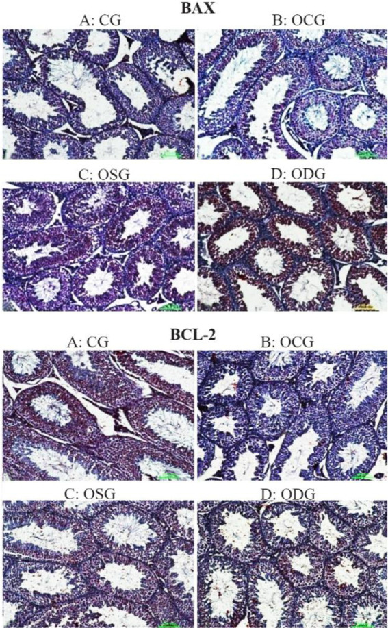 Figure 1. BAX expressions in the testis tissue; A) Negatif expression, B) +1 expression, C) +2 expression, D) +3 expression. BCL-2 expressions in the testis tissue; A) +3 expression, B) Negatif expression, C) +1 expression, D) +1 expression