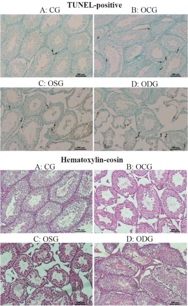 Figure 2. Representative testis sections stained in the TUNEL assay; arrows indicated TUNEL-positive cells. Representative hematoxylin–eosin (H&E)-stained testis sections quantitatively assessed through Johnson Score for spermatogenesis and germ