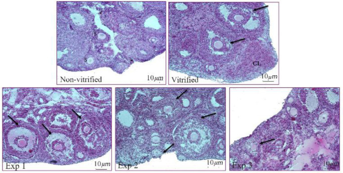 Figure 1. Cross sections of ovarian tissue in different groups (H&E staining, magnification *100). P: intact primordial/primary. S: intact secondary. CL: corpus luteum. The arrows represent the atretic follicle