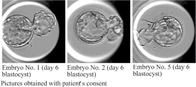 Figure 1. Pictures of the obtained blastocysts