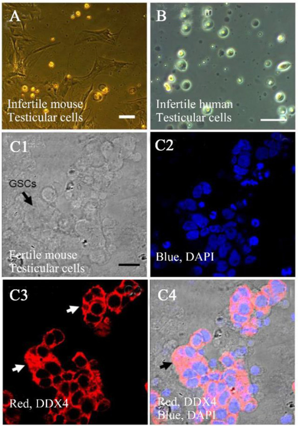 Figure 3. Bright field images of testicular cells in sterile and fertile mice and infertile human in vitro. Testicular cells from sterile mouse after expansion in culture (A). Infertile human testicular cell expansion in culture (B). Immunohistochemi