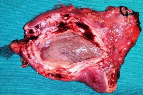 Figure 5. Uterus specimen