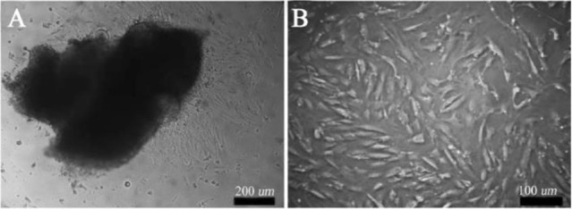 Figure 1. Cell isolation from ovarian cortical tissue. A) 5 days and, B) 20 days after human ovarian tissue culture in the culture plate