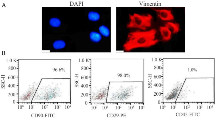 Figure 1. Immunophenotyping of ESCs isolated from eutopic endometriotic and non-endometriotic endometrial samples, A) immunofluorescence staining of both endometriotic and healthy ESCs, exhibiting the expression of vimentin as a stromal marker, B) fl