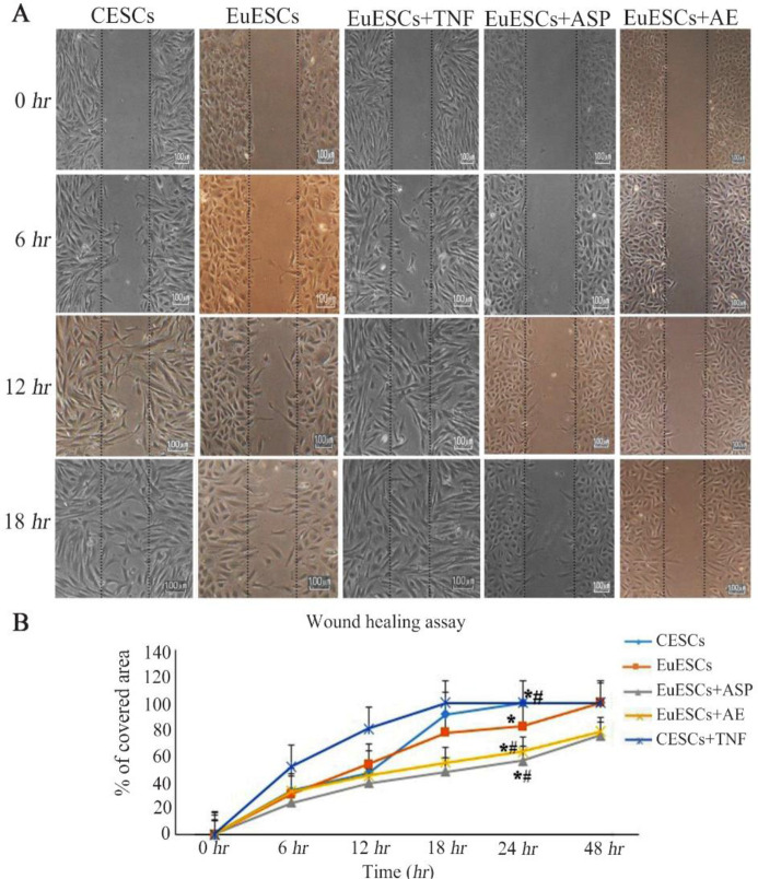 Figure 8. Migratory behavior in EuESCs of patients with stage IV endometriosis under Asp or AE treatment with in vitro wound healing assay, A) microscopic images of migration (Magnification×100). ESCs were cultured to 100% confluence and the in vitro