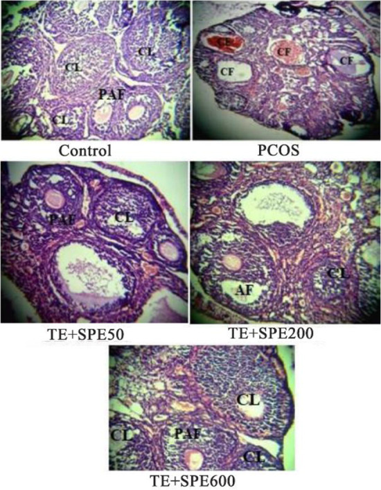 Figure 2. Histological analysis of normal ovaries (control) compared with PCOS and ovaries treated with SPE (TE+ SPE50, 200, 600). The morphological changes of the mice’ ovarian tissues were stained with hematoxylin and eosin, as described in the Mat
