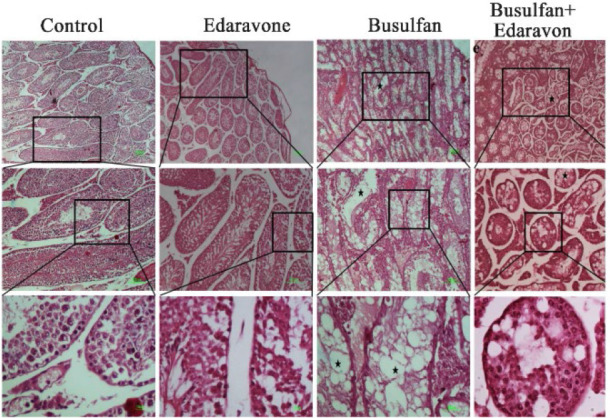 Figure 5. The effect of edaravone on the total number of spermatogenic cells in busulfan-induced mice. Photomicrograph of seminiferous tubules stained with H&E (4X, 10X, and 40X, respectively) in different groups. Empty seminiferous tubule (star)