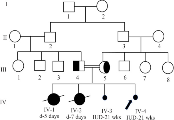 Figure 1. Four generation pedigree of a family with pseudo-TORCH syndrome