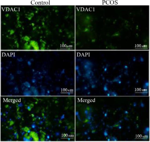Figure 1. VDAC1 protein levels were obtained by immunocytochemistry where green fluorescence intensities indicated cytoplasmic VDAC1 and blue DAPI fluorescence showed nuclear counterstain. Green and blue intensities were merged to obtain intensity ra