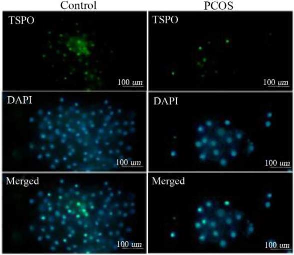 Figure 2. TSPO protein levels were obtained by immunocytochemistry where green fluorescence intensities indicated cytoplasmic TSPO and blue DAPI fluorescence showed nuclear counterstain. Green and blue intensities were merged to obtain intensity rati